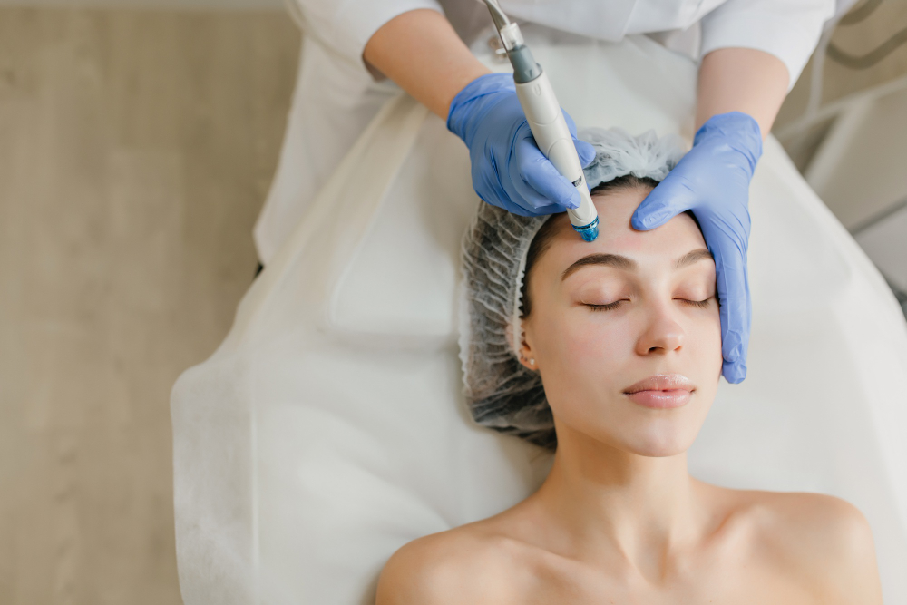 Microneedling Treatments in Hadley MA